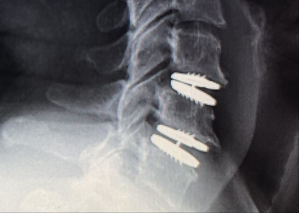 X-Ray